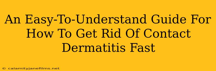 An Easy-To-Understand Guide For How To Get Rid Of Contact Dermatitis Fast